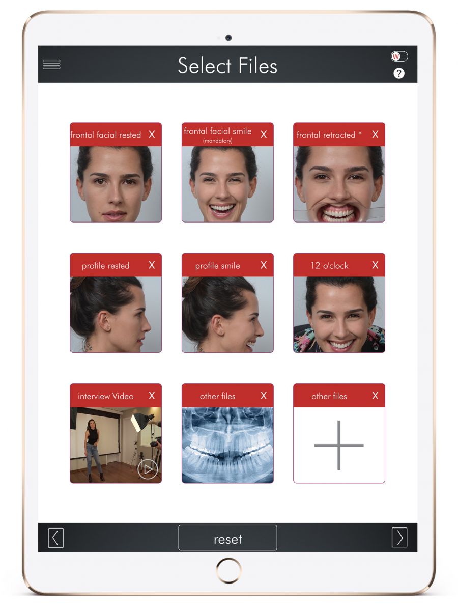 Esztétikai fogászat, a tökéletes mosoly kulcsa - STYLELIFE - Egészség - clinident, clinident fogászati centrum esztétikai fogászat 13.kerület fogorvos budapest budapest, esztétikai fogászat, 