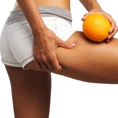 Narancsbőr - van megoldás! - Bőrápolás -  - egészség, narancsbőr, táplálkozás, 