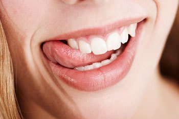 Az otthon végezhető és a LED-lámpás eljárások összehasonlítása -  -  - előnye, fogfehérítés, fogorvos, hátránya, lámpa, led, led-lámpás, otthon, összehasonlítás, 