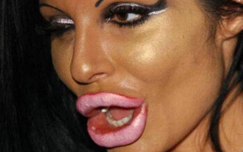 Plasztikáról őszintén - STYLELIFE -  - esztétika, korrekció, mellnagyobbítás, műtét, orrplasztika, önkép, plasztikai műtét, szépség, 