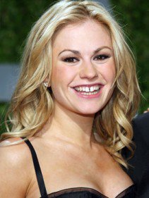 Sztárok, akik vállalják hibáikat - SZÉPSÉG - STYLELIFE - elfogadás, hibák, kicsi mell, mellimplantátum, orrplasztika, plasztikai sebészet, sztárok plasztikai műtét, 