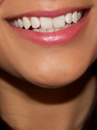 Öt rúzs a fehér fogakért - SZÉPSÉG - Smink  - fehér fogak, rúzs, smink, 