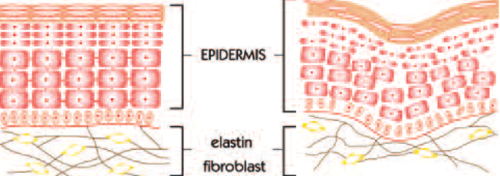 Illóolaj az illékony ifjúságra - SZÉPSÉG - Bőrápolás - bőrmegújulás, illóolajok, illóolajok hatása, öregedés, young living, 