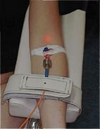 Forradalmian új anti-aging eljárás -  -  - anti-aging, 