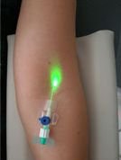 Forradalmian új anti-aging eljárás -  -  - anti-aging, 