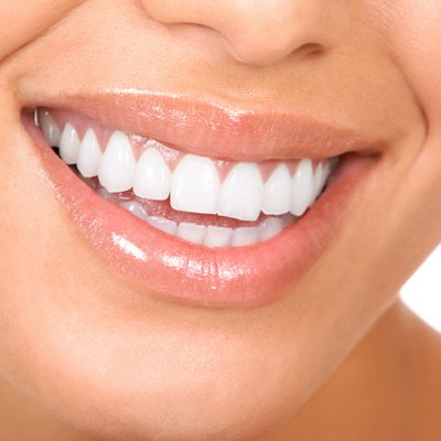 A hófehér hollywoodi mosoly története - SZÉPSÉG -  - fogfehérítés, 