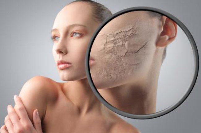 Ismerd meg a bőrtípusod! - SZÉPSÉG - Bőrápolás - bőrápolás, bőrtipusok, normál bőr, száraz bőr, szépség, 