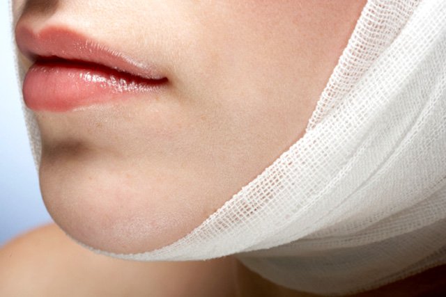 Természetes vagy művi szépség? - KERESD A NŐT  -  - agatha seymour, életmesék, 