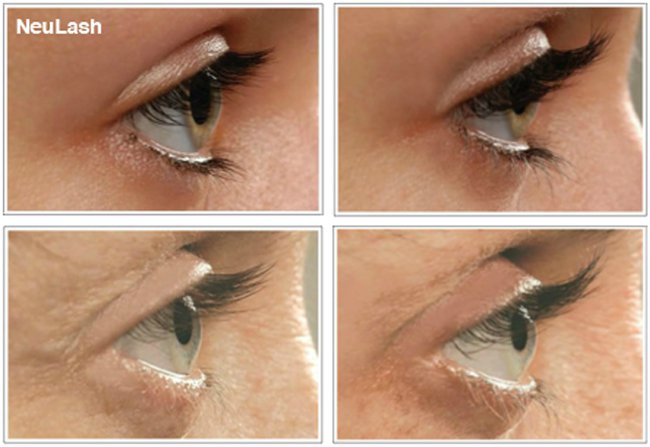 8 szempillanövesztő a hollywoodi tekintetért - SZÉPSÉG - Smink  - smink, szempillanövesztő, szépség, 