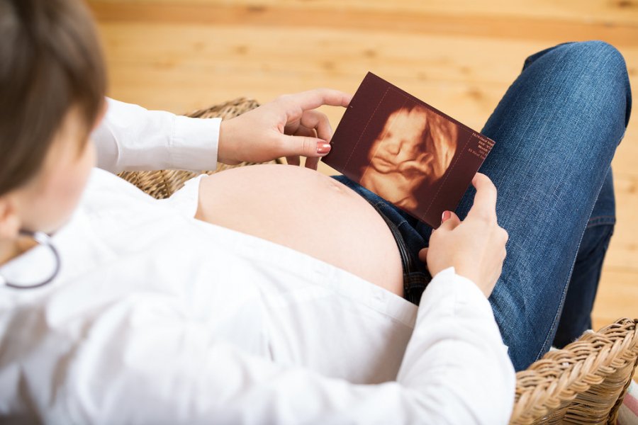 Miben segít az ultrahangos vizsgálat? - Stylekids -  - Doppler-ultrahang, fogantatás, kismama, terhességi ultrahang, terhességi ultranahg, ultrahang, utrahang vizsgálat, 