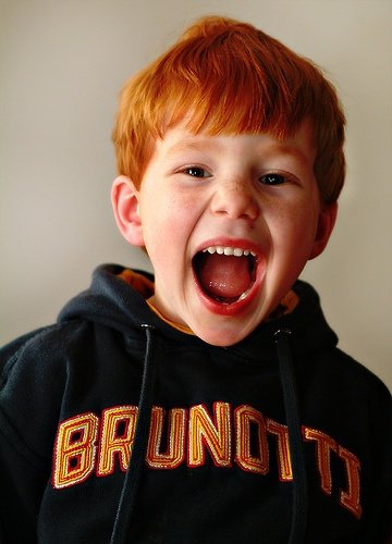 Ismerd fel a lekpehimlőt! - Stylekids -  - fájdalom, gyermekbetegség, gyermekhimlők, Human  Parvovírus B19., láz, lepkehimlő, ötödik betegség, pillangó kór, 