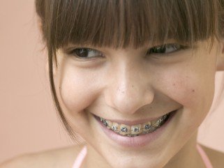 Iskolai szünetben szépülnek a fiatalok -  -  - Dr. Kis-Márton Huba, Egressy Dental, fogszabályozó, szünetben szépülnek, 