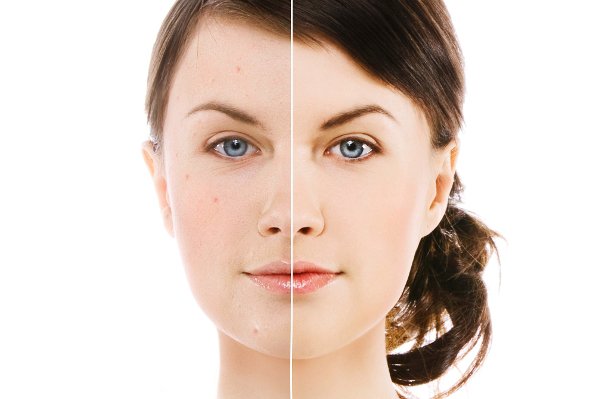 Teszt: selymes, puha, ránctalan - SZÉPSÉG - Bőrápolás - beauty, bőrápolás, 