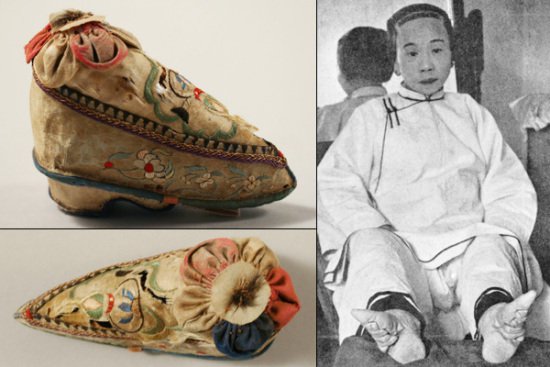 A cipőtörténelem 10 legbizarrabb pillanata - DIVAT&STÍLUS - Fesztelen mindennapok - cipő, divat, divat történelem, 