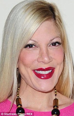 Zellweger új arca és sztárok legnagyobb transzformációi - STYLENEWS -  - hírességek, plasztika, renee zellweger, 