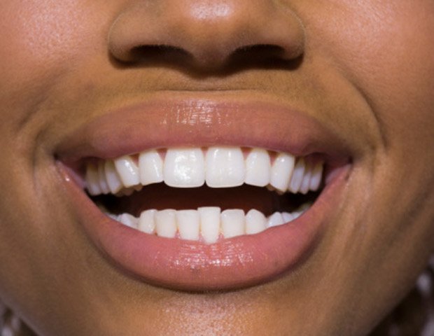 Legyél te is szakértő a szájápolásban! -  -  - Blend-a-med, Pro-Expert All-In-One, 