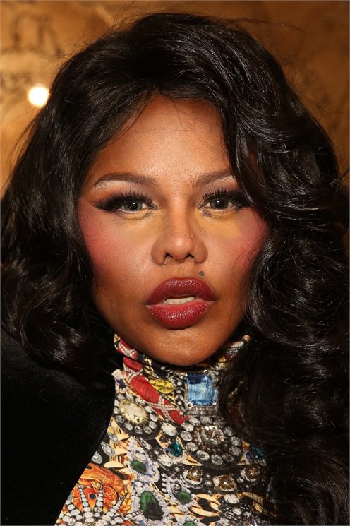 A 20 leghíresebb plasztikai műtét katasztrófa - DIVAT&STÍLUS - Celebrity - 