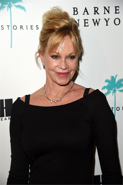 A 20 leghíresebb plasztikai műtét katasztrófa - DIVAT&STÍLUS - Celebrity - celebrity, plasztikai műtét, 