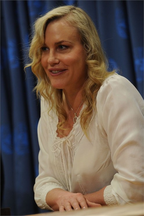 A 20 leghíresebb plasztikai műtét katasztrófa - DIVAT&STÍLUS - Celebrity - celebrity, plasztikai műtét, 