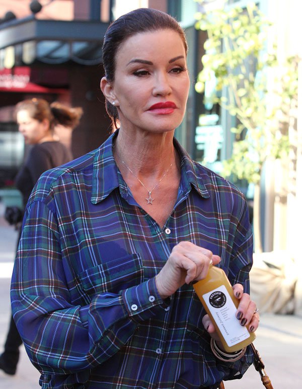 A 20 leghíresebb plasztikai műtét katasztrófa - DIVAT&STÍLUS - Celebrity - celebrity, plasztikai műtét, 