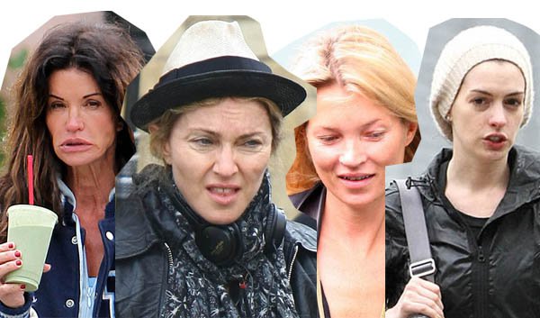 30 híresség sokkoló smink nélküli képei - DIVAT&STÍLUS - Celebrity - celebrity, molnár dorka, nomakeup, the sense, 