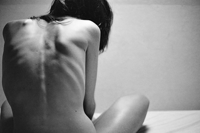 Testem az elmém börtönében - KERESD A NŐT  - Lélekhangok - anorexia, betegség, éhezés, lélek, testképzavar, 