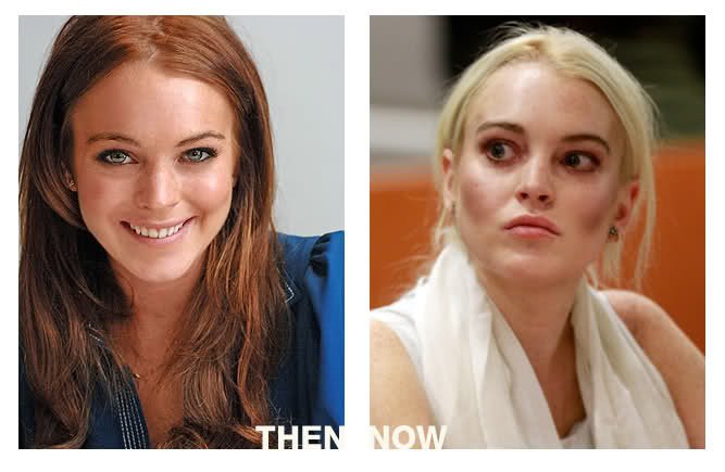 A hírnév után - 9 meghökkentő fotó letűnt sztárokról - Celebrity -  - akor és most, celebrity, haley joel osment, kirstie alley, matthew perry, tara reid, val kilmer, 