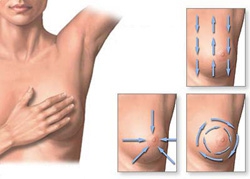 Az egészséged védelmében - STYLELIFE -  - egészség, emlőrák, nők, prevenció, 