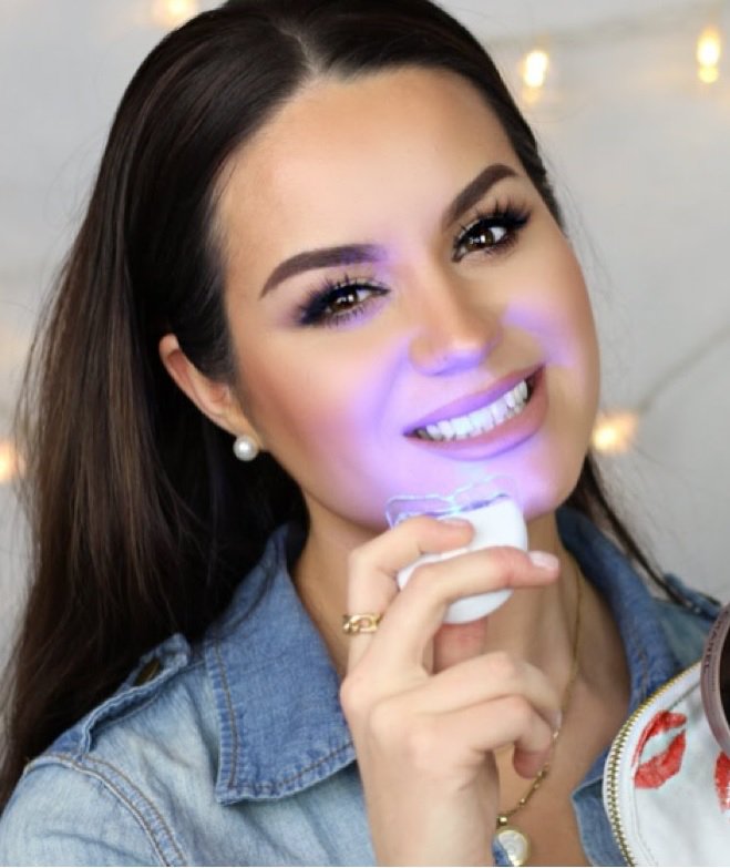 Amit tudni érdemes az otthoni fogfehérítésről - STYLELIFE -  - egészség, fogápolás, fogfehérítés otthon, 