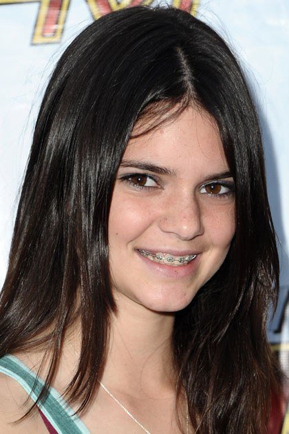 Miből lesz a cserebogár: Kendall Jenner átalakulása - DIVAT&STÍLUS - Celebrity - evolúció, Kendall Jenner, szépség, 