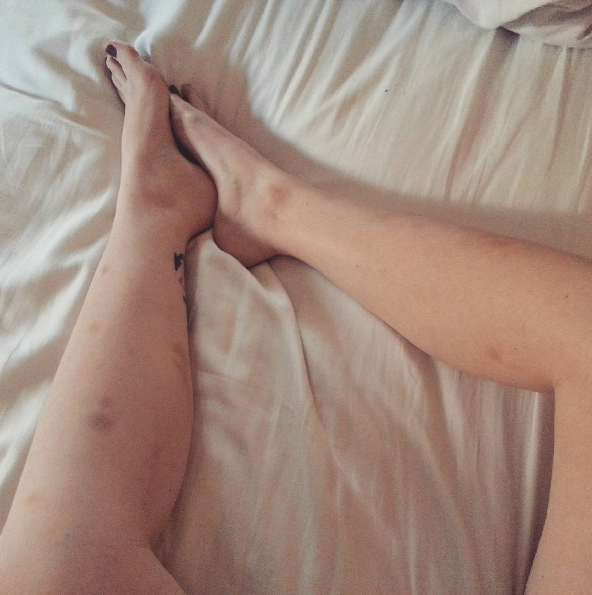 10 dolog, amit érdemes tudni a rúd fitnessről - STYLELIFE - Egészség - rúdfitness, sport, tudnivalók, 