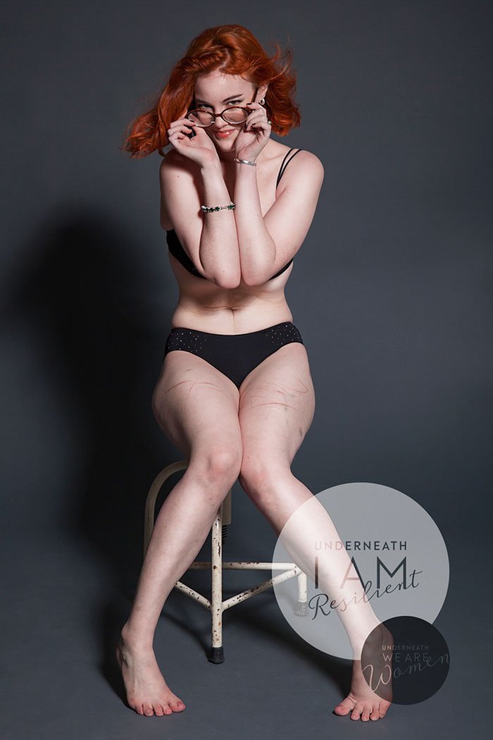 Inspiráló fotóprojekt bátor nőkről, ruha nélkül - STYLENEWS - Aktuális - fotóprojekt, inspiráció, önbizalom, szépség, 